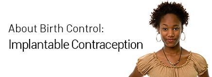 About Implantable Contraception