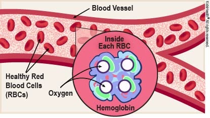 Diagram showing a blood vessel with healthy red blood cells (RBCs) and the oxygen and hemoglobin inside each RBC, as described in the article. 