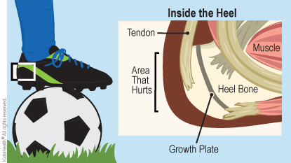 Diagram labels inside the heel, muscle, heel bone, growth plate, tendon, heel bone, and area that hurts