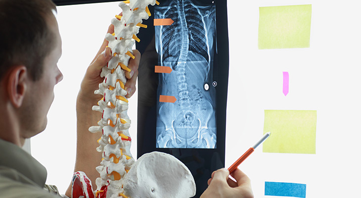 Scoliosis Traction Chair (STC) Market 2022-2028: Key Players